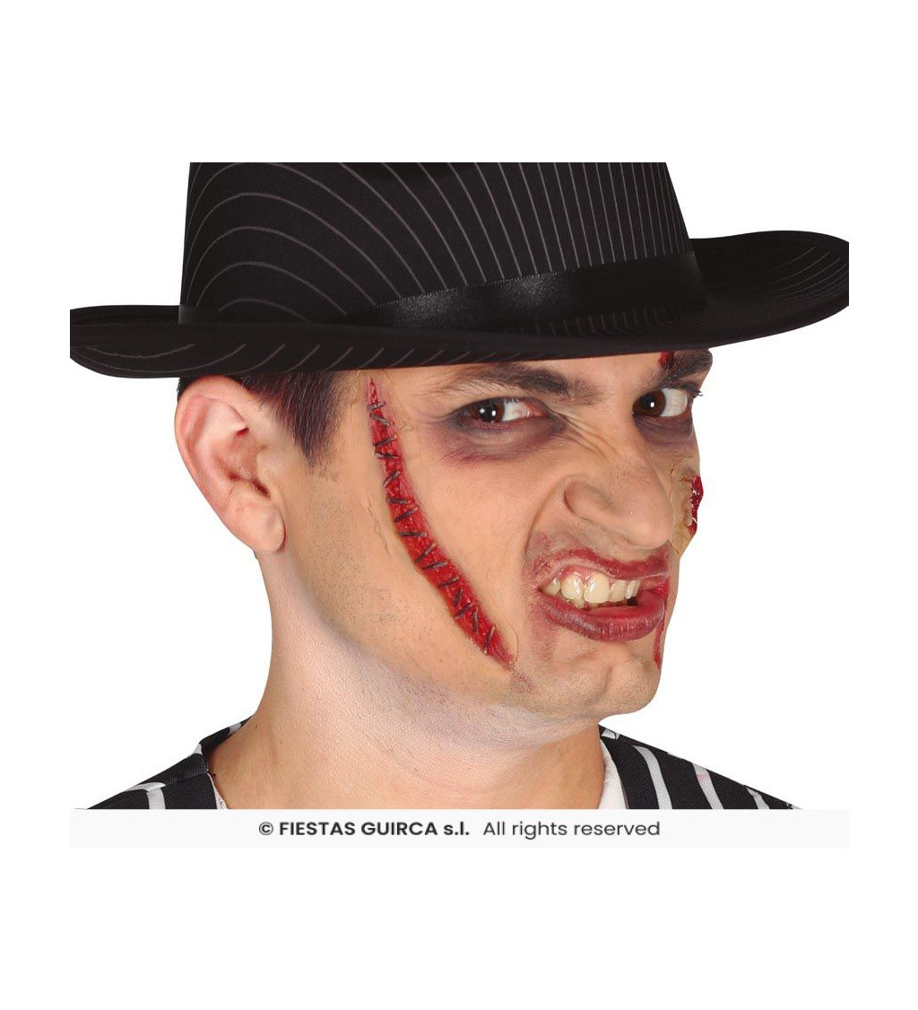 Jizva - šitá kůže