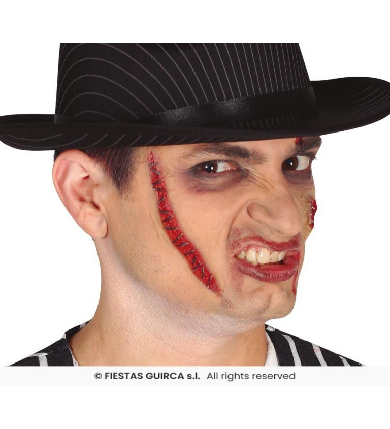 Jizva - šitá kůže